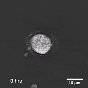 Macrophage cell dying in response to TNFR2 using Nanolive Imaging microscope
