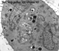 Ad2-ts1 (EM)
