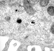 EM's of Ad2 in coated pits, coated and uncoated vesicles