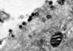 Surface-bound Ad2 (EM)