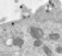 EM's of Ad2 in coated pits, coated and uncoated vesicles