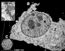 HeLa cell infected with Ad2 for 60 min (EM)