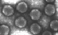 EM of negatively stained Ad2